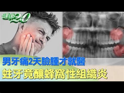 牙痛 臉腫 天格是什麼